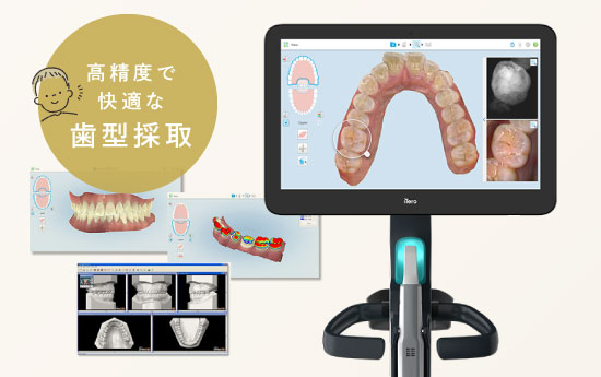 高精度で快適な歯型採取